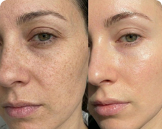 Finally, a glow that lasts.